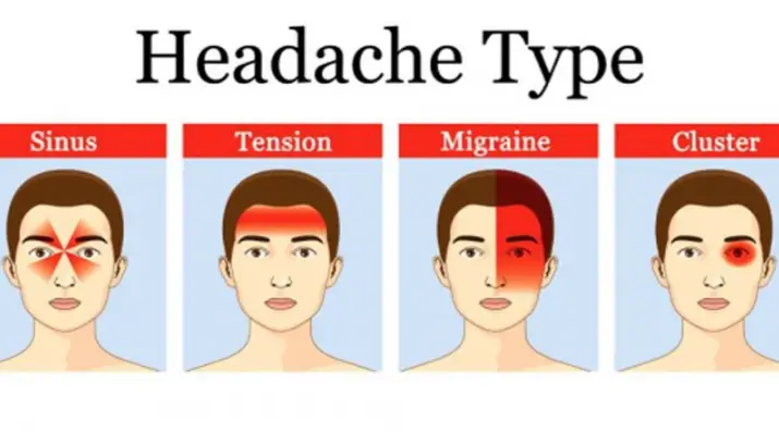 19 Luxury Headache Location Chart And Meaning