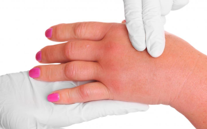 Sudden Wrist Pain For No Reason