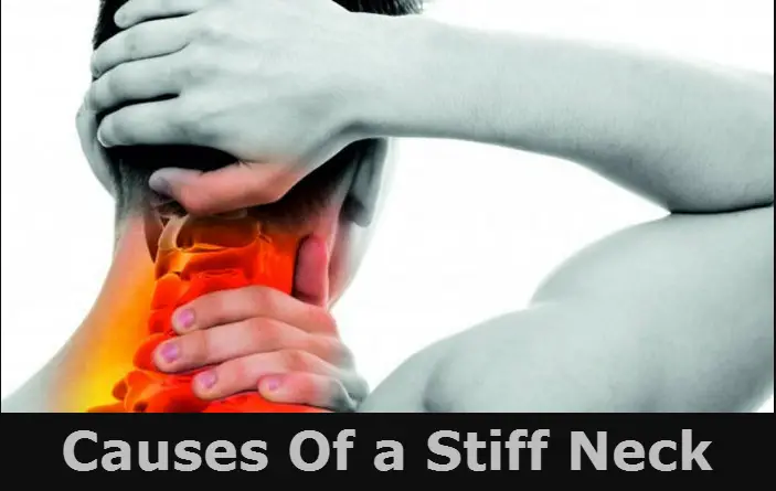 causes-of-a-stiff-neck