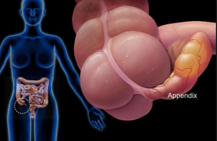 How Constipation Worsens Pelvic Pain