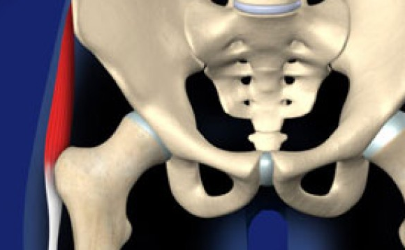 How to get rid of snapping hip syndrome