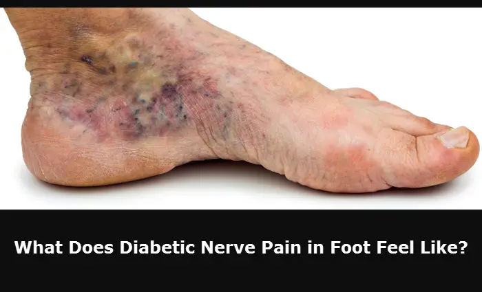 burning nerve endings in feet