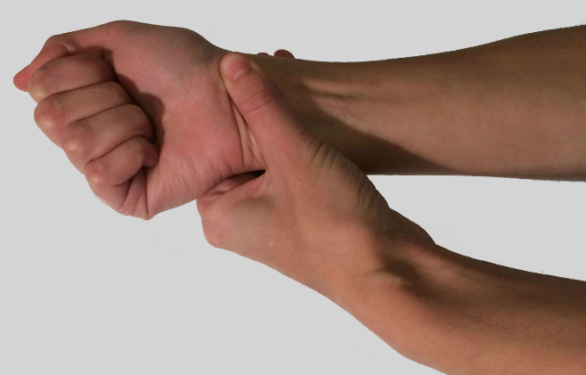 carpal tunnel vs rsi