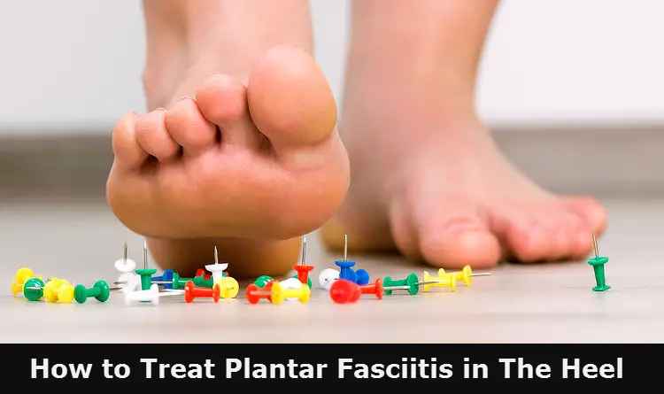 how to treat plantar fasciitis in heel
