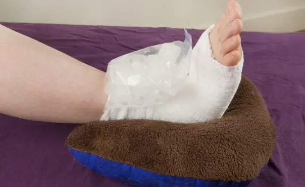 Should You Wrap a Sprained Ankle - home injuries