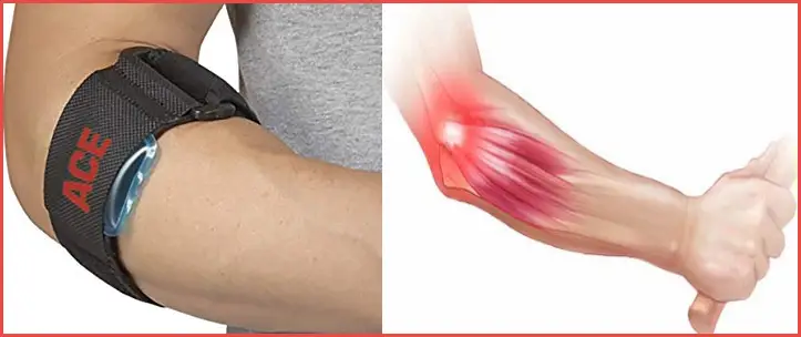 How to Cure Tennis Elbow Quickly